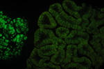 Bioluminescent Coral